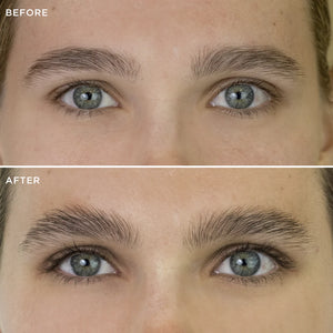 Multi-Peptide Growth Serum